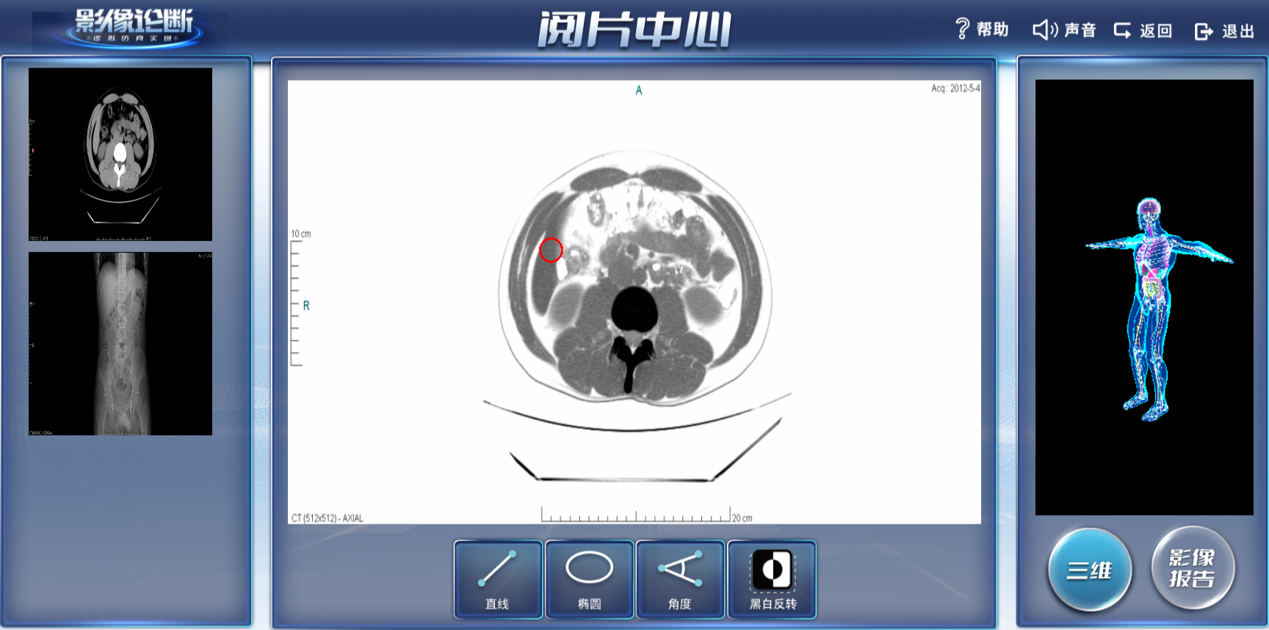 影像診斷虛擬仿真系統